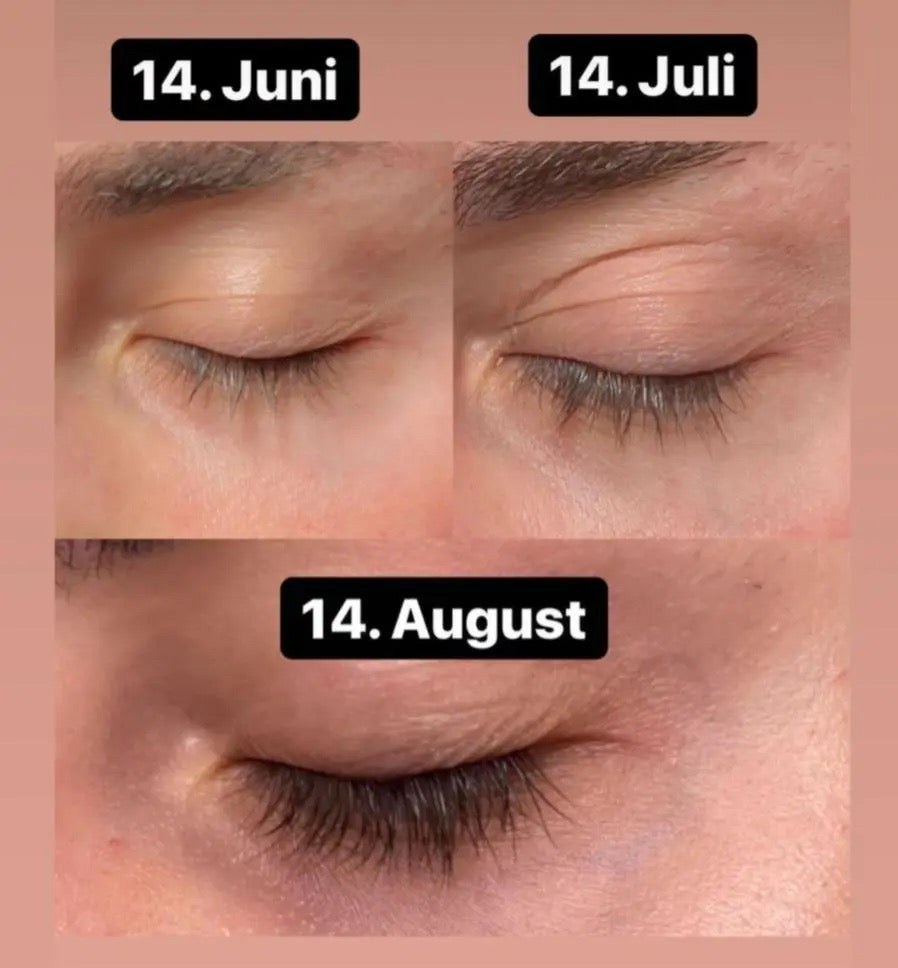 WonderLash - langere, dikkere en donkere wimpers binnen enkele weken