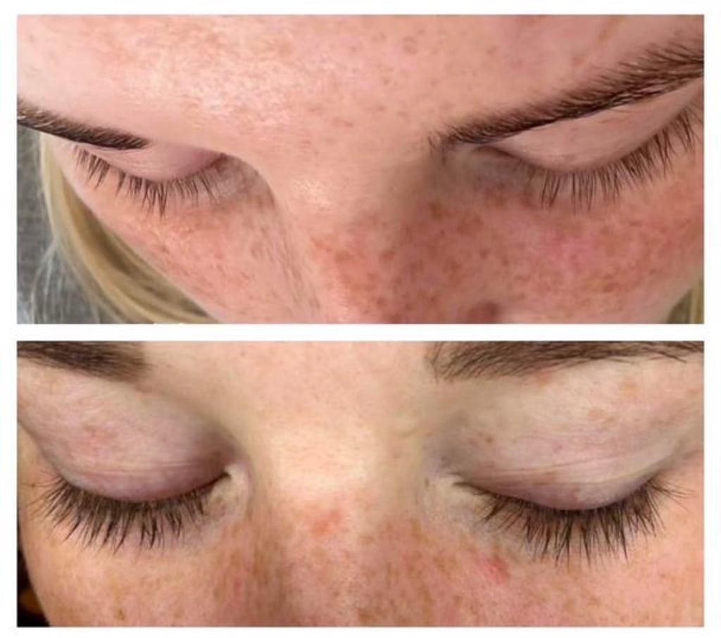 WonderLash - langere, dikkere en donkere wimpers binnen enkele weken