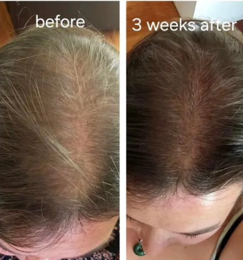 HairGrowth oil - snel voller, langer, dikker haar binnen enkele weken